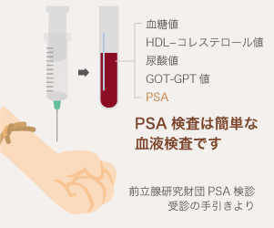 PSA検査